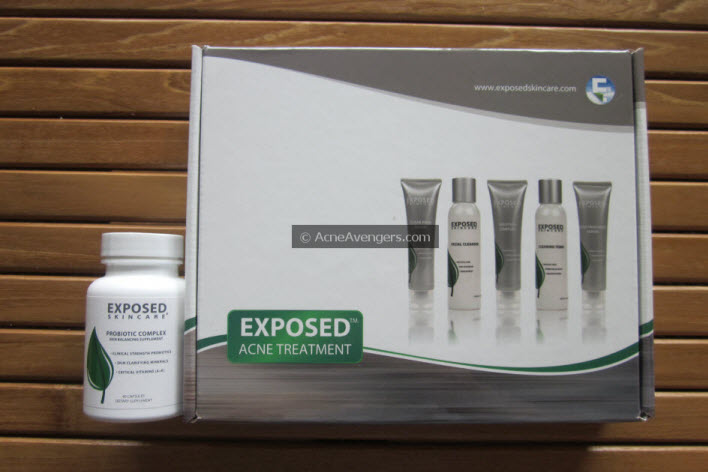 Exposed Acne Skincare Box Exposed Acne Skincare Box