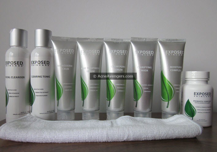Exposed Acne Treatment Exposed Acne Treatment